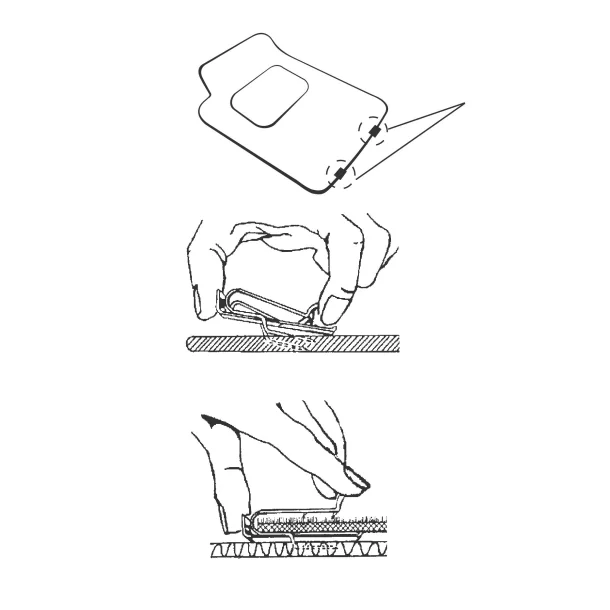 Mat fixing clips-Resealed,